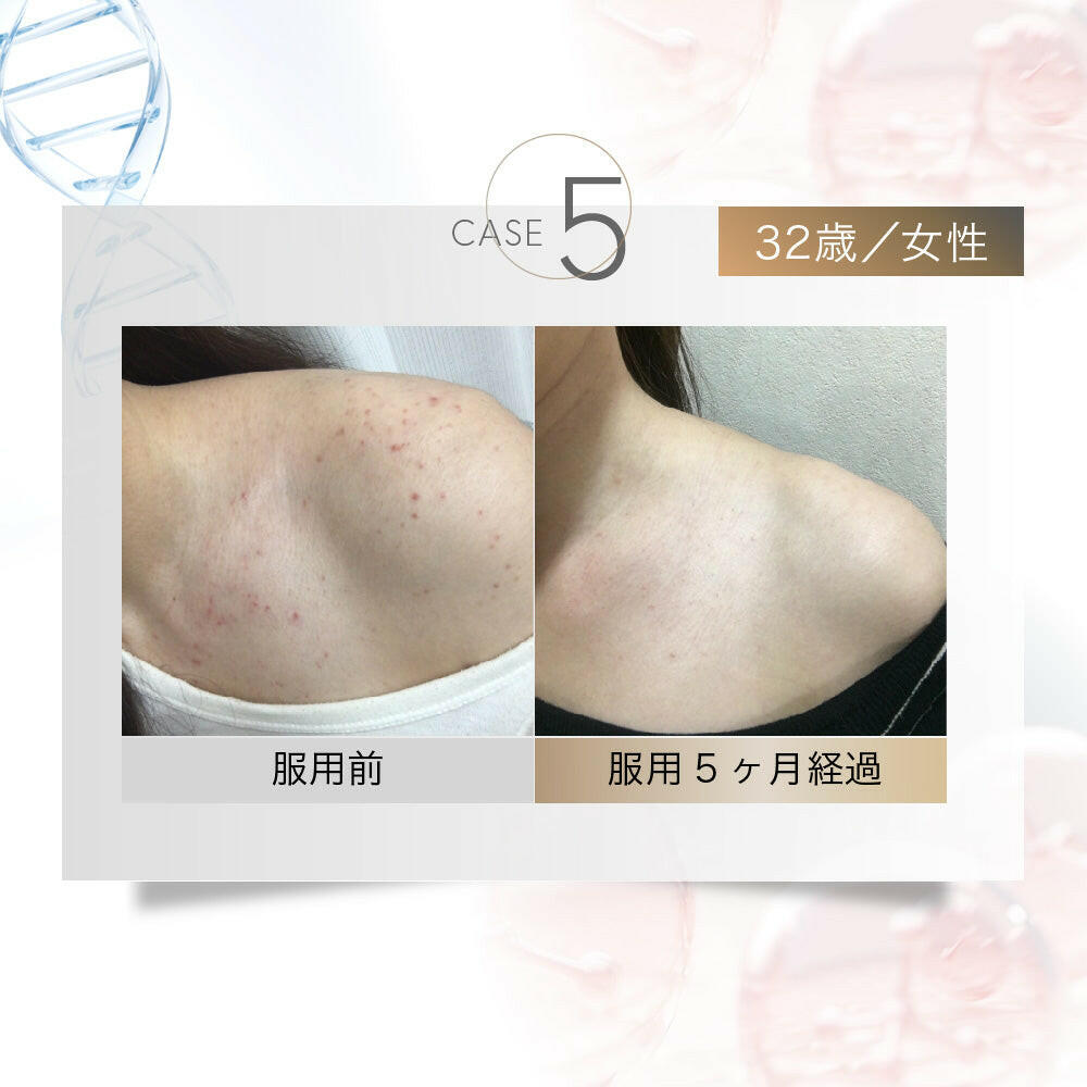 【定期便(1か月毎)】5デアザフラビン TND1128